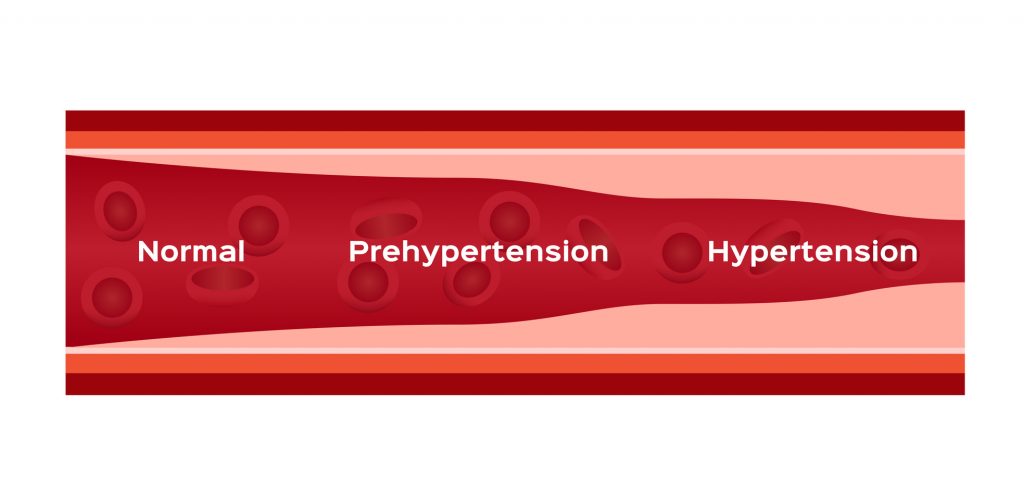 effects of salt causing arterial damage